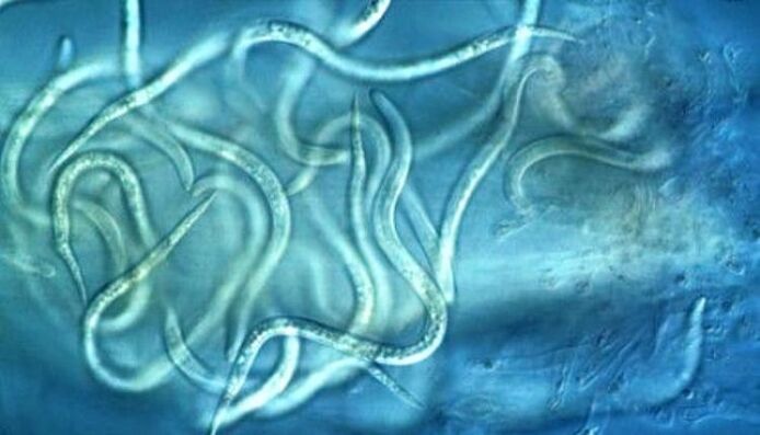 как изглеждат паразитите нематоди в човешкото тяло