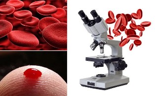 гемосканирование кръв